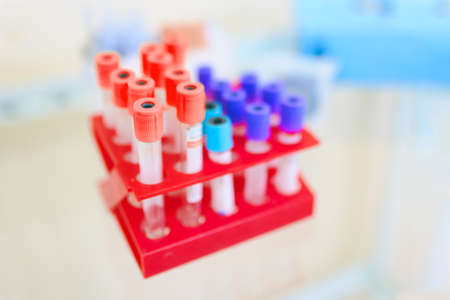 Laboratory test tubes with tests for research. A set of test tubes with different biomaterials for scientists  tests. Hospital. Tube for transporting laboratory flasksの写真素材