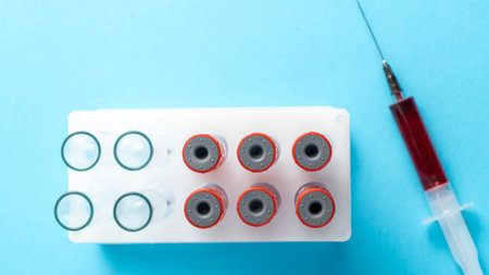 Vials with blood and a syringe with the patients blood on a blue background top view. Human blood test for various diseases. General extensive human blood analysis concept. High quality photoの写真素材