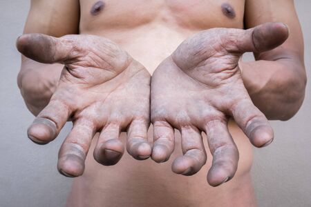 Dirty hands of male workers. Selective focus. Abstract background.