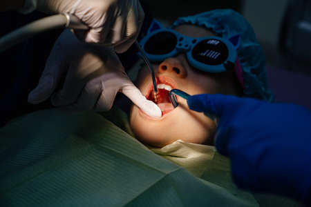 oral hygiene and treatment of the child. teeth cleaning at stomatologistの写真素材
