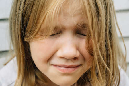 Portrait girl with an abrasion under her eye. child abuse. wounds and abrasionsの写真素材