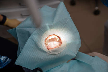 real. preparation for brushing teeth of patient. regular care and prevention.の写真素材