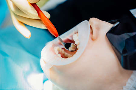 real. dentist examines patients teeth. regular care and prevention.の写真素材