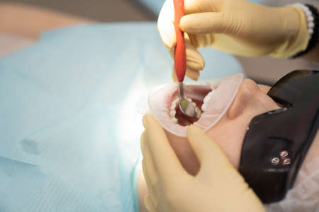 real. dentist examines patients teeth. regular care and prevention.