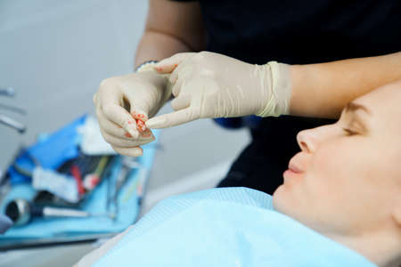 real. dentist pulls out a sick wisdom tooth.