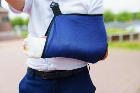 a man with a broken arm in a cast. treatment of limb fractures.