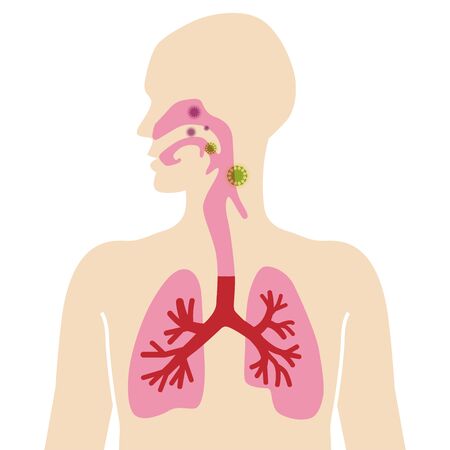 Anatomical human body diagram for Respiratory system -infected with virusのイラスト素材