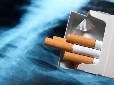 Packs of cigarettes with lung x-ray image in the background の写真素材