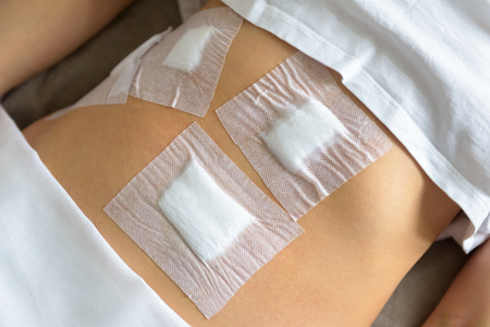 Young woman's belly after operation by laparoscopy in the hospital. The abdomen sealed with plaster...