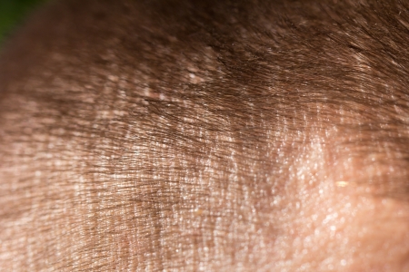 background of the hair. macroの写真素材