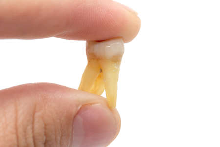 tooth in his hand on a white background