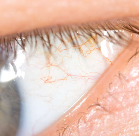 veins in the eyes of men. macroの写真素材