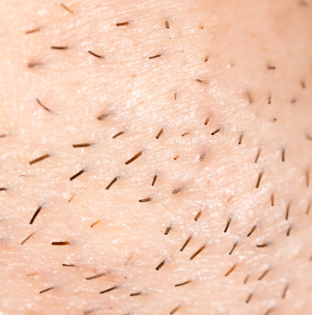 the bristles on the skin. macroの写真素材