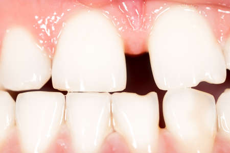 Teeth men as a background. macroの写真素材