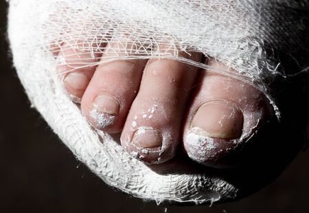 leg in a plaster cast on a black background