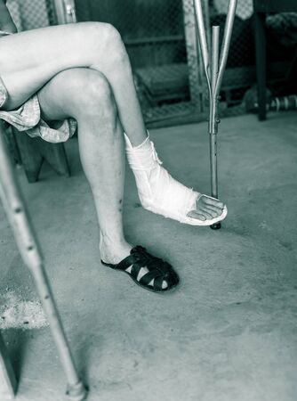 broken leg in a cast male