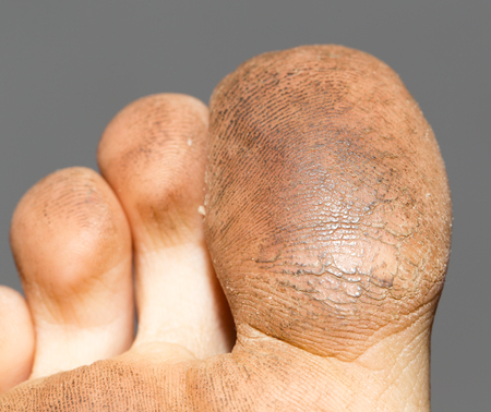 dirty toesの写真素材