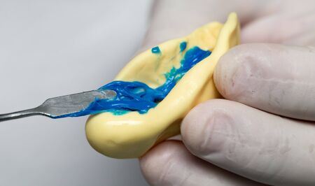doctor makes a plastic prosthetic dentistryの写真素材