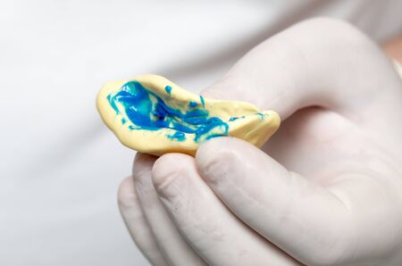 doctor makes a plastic prosthetic dentistryの写真素材