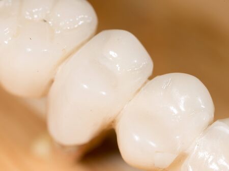 tooth torn. macroの写真素材