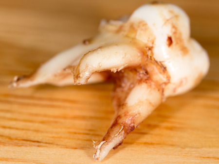 tooth torn. macroの写真素材