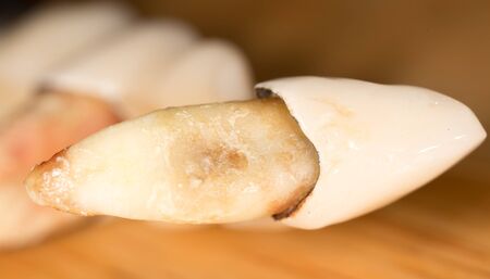 tooth torn. macroの写真素材