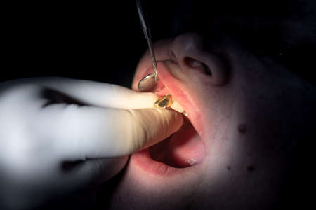 The dentist works with the client in the clinic .の写真素材