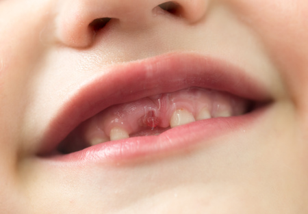 The mouth of a boy without a tooth .の写真素材