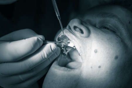The dentist works with the client in the clinic .の写真素材