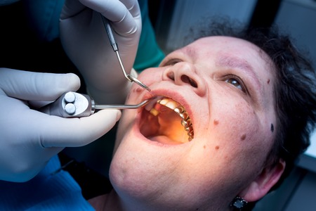 The dentist works with the client in the clinic .