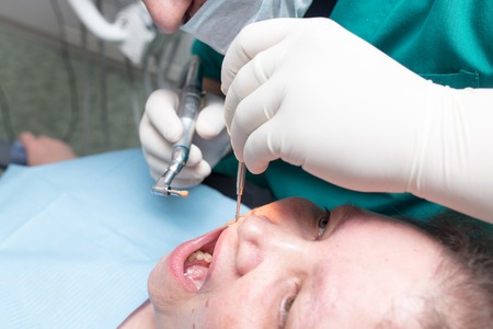 The dentist works with the client in the clinic .の写真素材