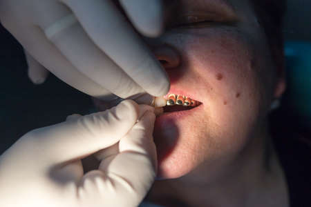 The dentist works with the client in the clinic .