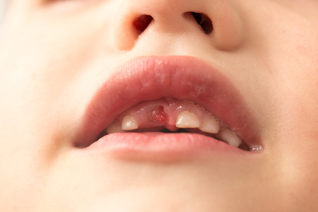 The mouth of a boy without a tooth .の写真素材