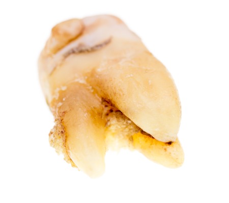 Old torn tooth on a white background .
