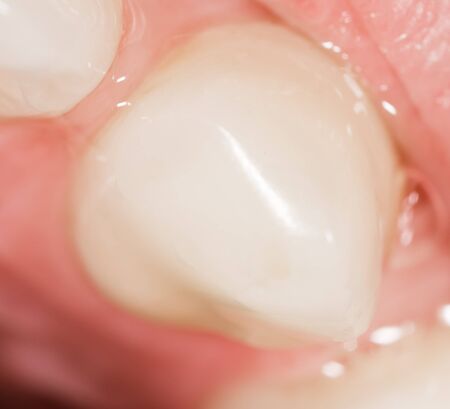 Teeth in a man's mouth as a background. macro