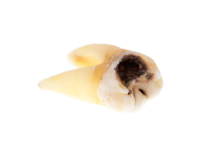 Old torn tooth on a white background .の写真素材