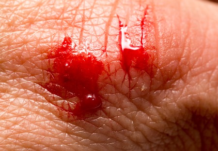 Blood on the skin from a cut with a knifeの写真素材