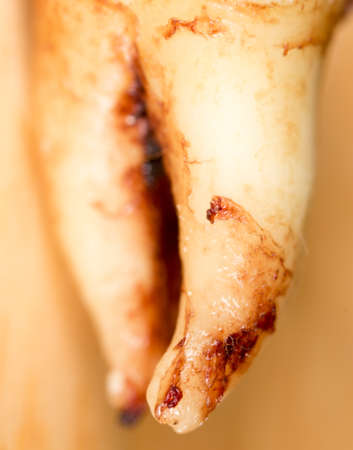 Root on the teeth of a man. Macroの写真素材