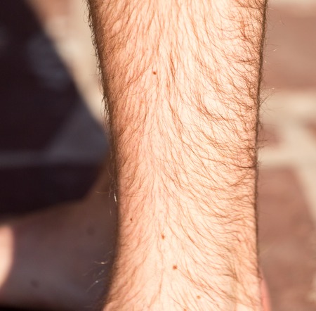Hair on the legs of a man .の写真素材