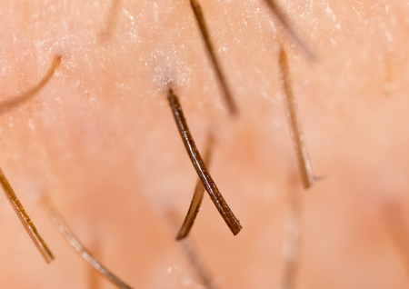 Bristles on the beard of a man. Macroの写真素材