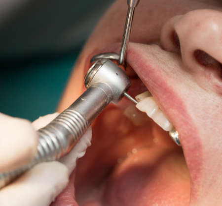A dentist makes teeth to a woman .