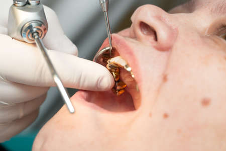 A dentist makes teeth to a woman .の写真素材