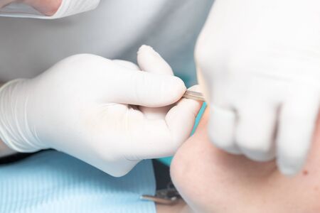 Hands in gloves at the surgeon during the operation .の写真素材