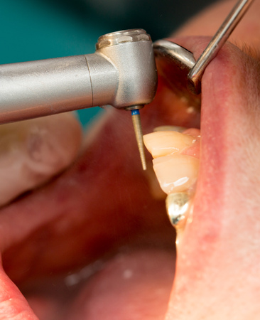 A dentist makes teeth to a woman .の写真素材
