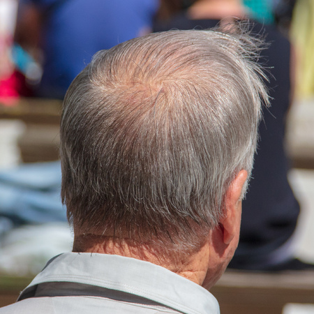 Bald head on an old man's head .の写真素材