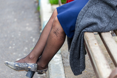 Legs of a girl in torn pantyhose sitting on a bench .の写真素材