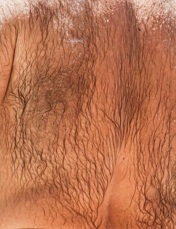 Hair grows on the back of a man.の写真素材