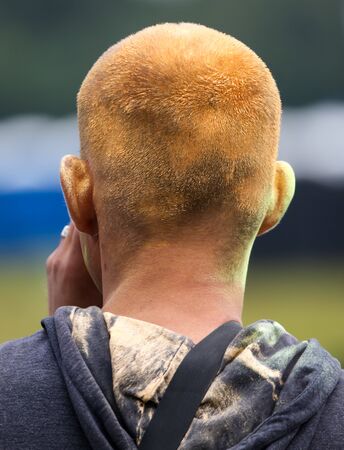 Yellow paint on a manâ€™s head.