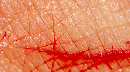 Close-up of blood from a wound on a human skin. Macroの写真素材
