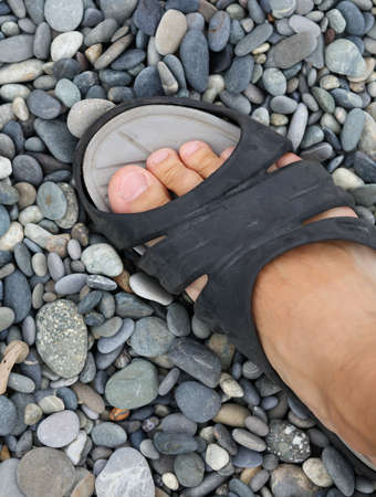 Man's leg on a pebble near the sea.